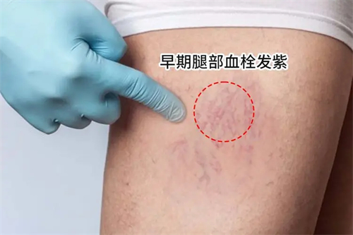 图片细节说明
